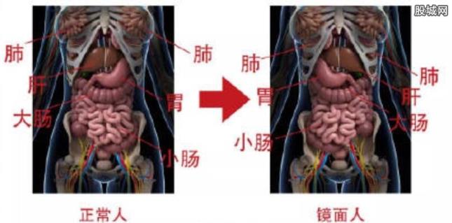 一女子五脏六腑全部反着长,一旦患病会带来巨大障碍